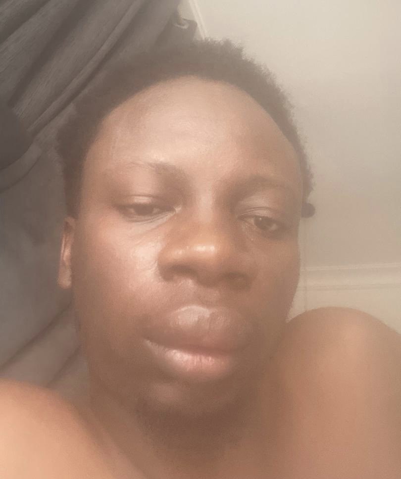 Adigoon_'s tweet photo. @iamnasboi @Oyeetunjii @iamnasboi Kindly assist.🙏 I need money for drugs &amp; inhaler as soon as it’s possible. I’ve been tagging you for days &amp; earlier this morning.🙏  May God bless you.
0248363862
Wema
Olanrewaju

It’s mouth ulcer that made my lips big. Need second root canal.
https://t.co/p24hpkO6EN https://t.co/5yDcH3D1UQ