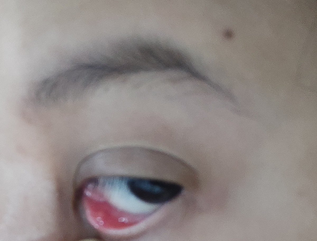 ohoneyku's tweet photo. YaAllah bintitan lagi😭 https://t.co/oJe7QFZoFO