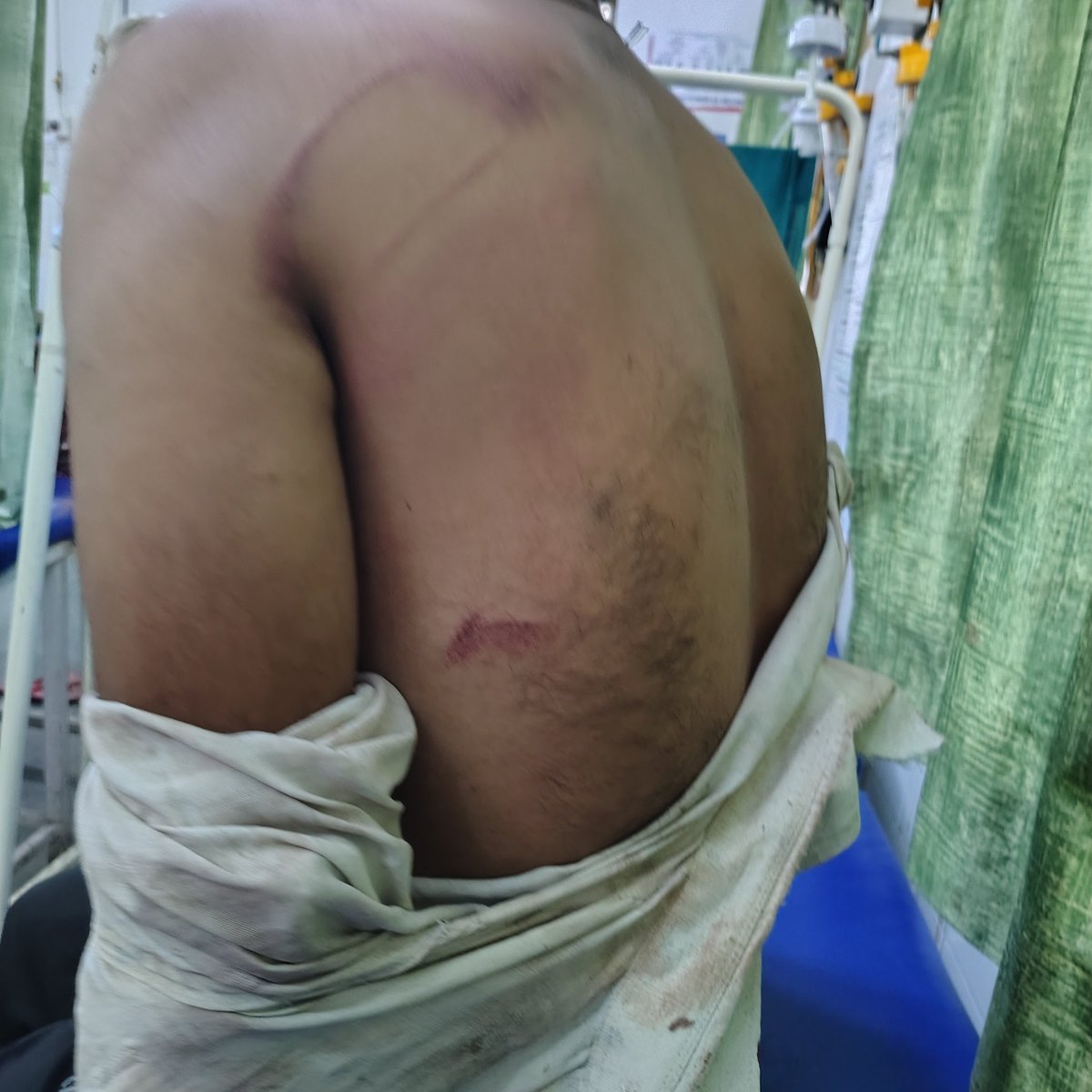 mentooindia91's tweet photo. @Uppolice @muzafarnagarpol
@dgpup महोदय 
26/05/2026 को पीड़ित ने थाना नई मंडी मुजफ्फरनगर में तहरीर दी है ।
30/05/2026 में फिर पीड़ित ने SSP कार्यालय में तहरीर दी है ।
SSP कार्यालय के बाद भी,लेकिन आज 12 दिन हो गए हैं लेकिन कोई FIR नहीं हुई है । https://t.co/3NMPUutKld