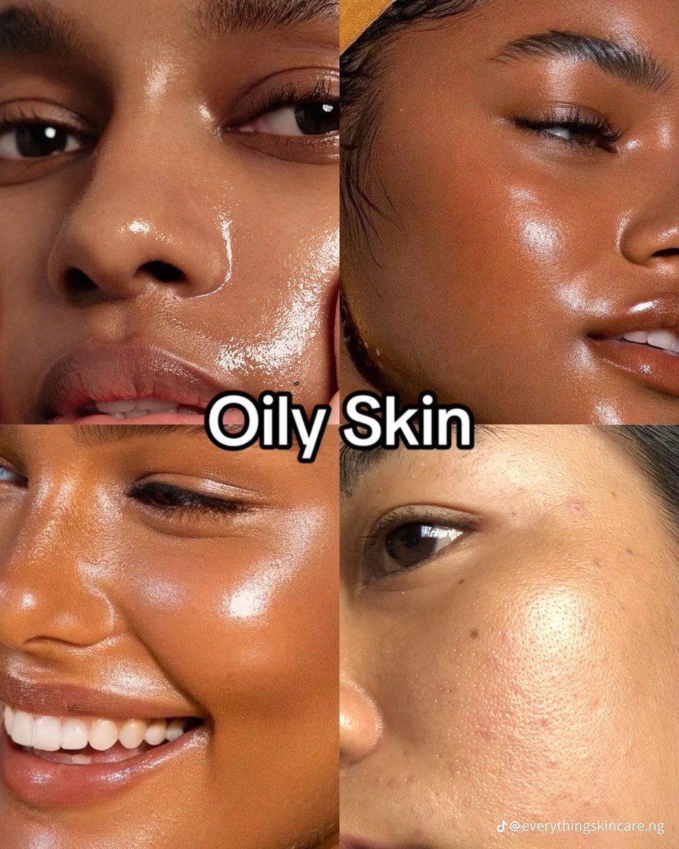 sandra_baebae's tweet photo. This is for the oily skin Girlies 

You can try these products out.

DISCLAIMER: Results may vary , Not medical advice . consult a Dermatologist. https://t.co/03Xibv785f