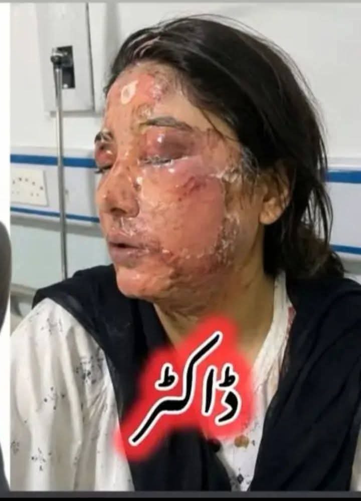 kb_dawar's tweet photo. We categorically denounce any aggression against healthcare personnel — physicians, nurses, paramedics, porters, custodial staff. Such assaults undermine public welfare and must not be tolerated.

#JusticeForDrMahNoor

#AcidAttack #Quetta 
#DrMahnoor #Pakistan 
@HRCP87  @BBCUrdu
 #SaveMedicalProfessional