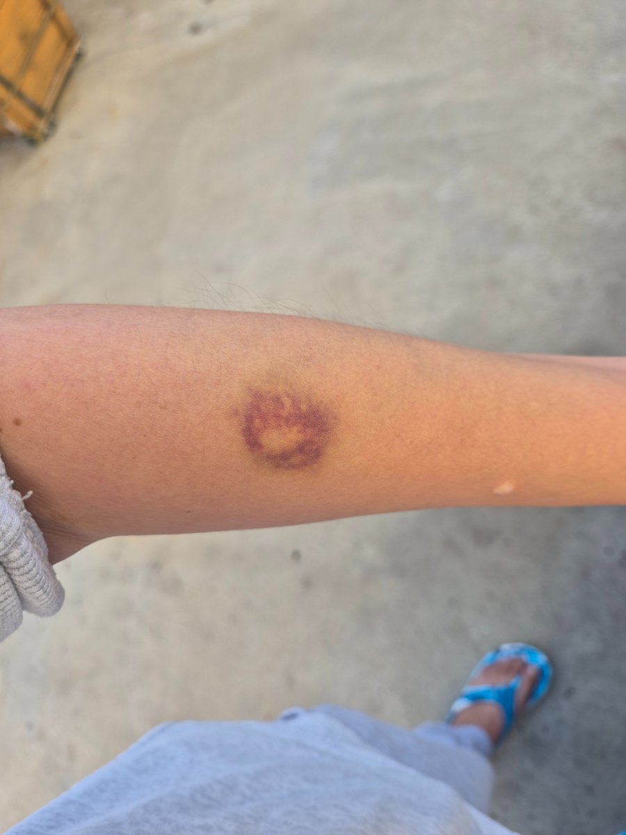 CTIVE_'s tweet photo. My dad told my Mom to do this to me so he could get away with it https://t.co/Qx8NbKPJDp