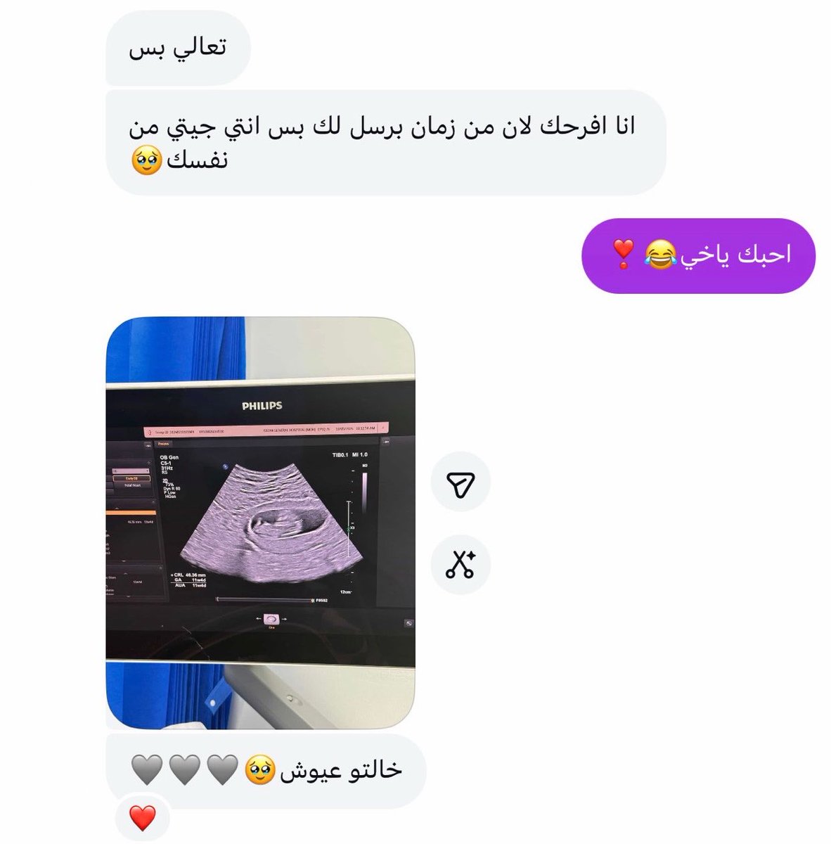 AY23jm's tweet photo. اختي وحياتي وصديقة أيامي بتجيب لي حٌب حياتي ( الله يحفظها ويقومها بالسلامه هي والنونو ) 🥹🤍🤍🤍🤍🤍🤍 https://t.co/lK4krkno6h