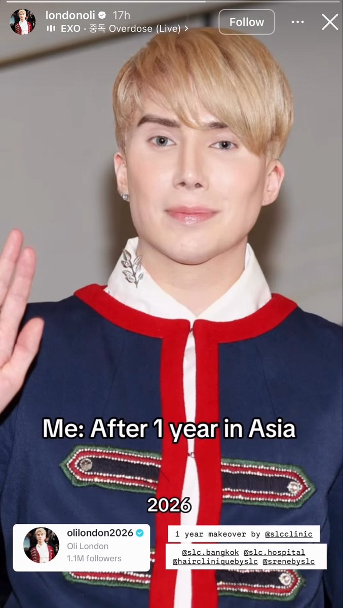 p4lrb07's tweet photo. @OliLondonTV why do you hide your REAL actions from the maga crowd? Here’s oli RECENTLY getting MORE surgeries and still dementedly claiming he’s a “ k-pop artist “ LOL all that and you still look like an old melted fridge in a cheap wig. https://t.co/sh38kP5zYO