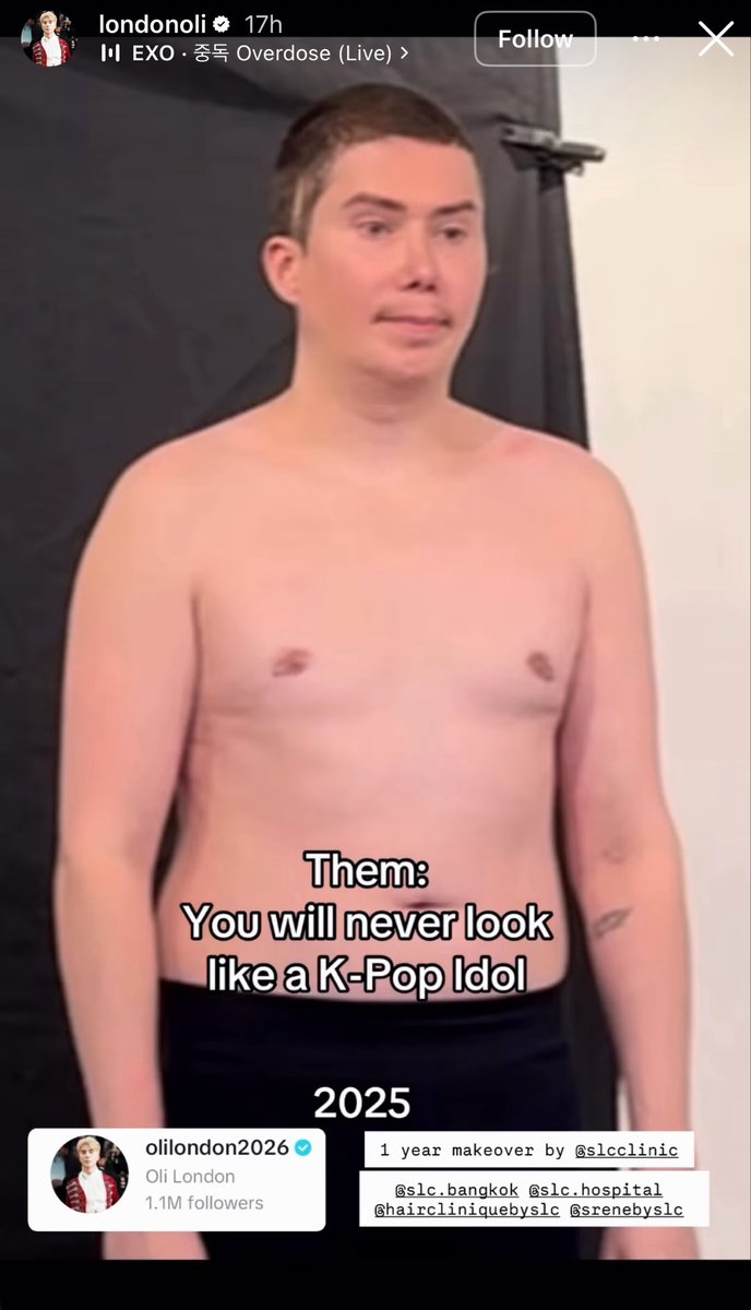 p4lrb07's tweet photo. @OliLondonTV why do you hide your REAL actions from the maga crowd? Here’s oli RECENTLY getting MORE surgeries and still dementedly claiming he’s a “ k-pop artist “ LOL all that and you still look like an old melted fridge in a cheap wig. https://t.co/sh38kP5zYO