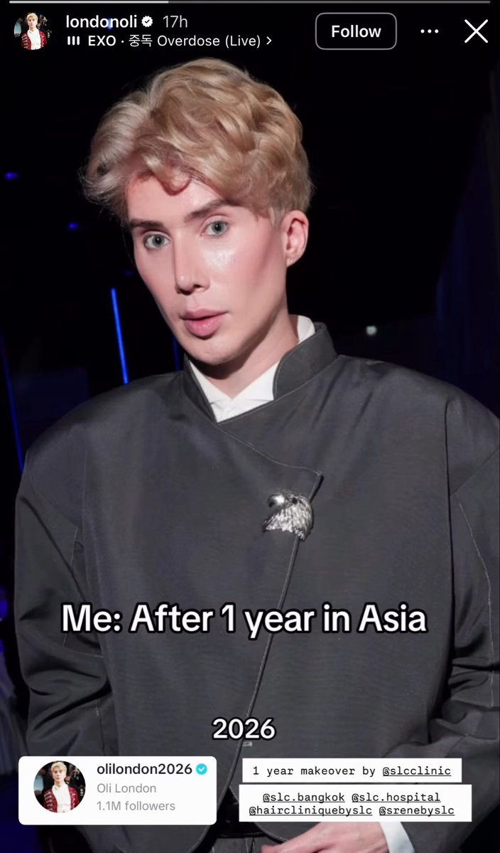 p4lrb07's tweet photo. @OliLondonTV why do you hide your REAL actions from the maga crowd? Here’s oli RECENTLY getting MORE surgeries and still dementedly claiming he’s a “ k-pop artist “ LOL all that and you still look like an old melted fridge in a cheap wig. https://t.co/sh38kP5zYO