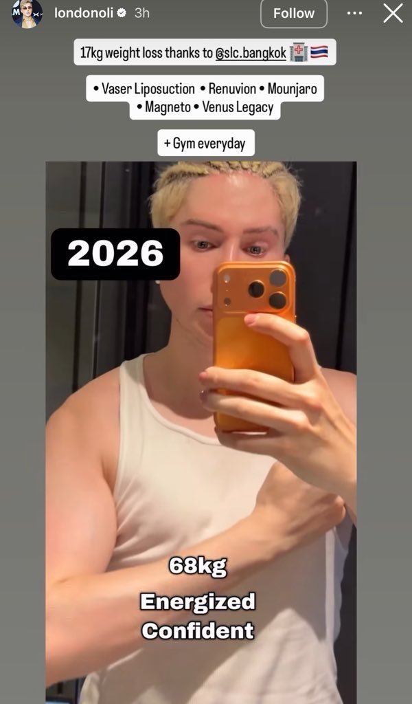 p4lrb07's tweet photo. @OliLondonTV why do you hide your REAL actions from the maga crowd? Here’s oli RECENTLY getting MORE surgeries and still dementedly claiming he’s a “ k-pop artist “ LOL all that and you still look like an old melted fridge in a cheap wig. https://t.co/sh38kP5zYO