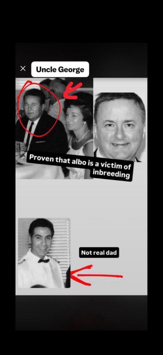 HDFatSlim's tweet photo. I draw a distinction between Carlo Albanese and your Uncle George Ellery Jnr.

One is your fake father and the other your real father.

Facts;

His grandfather George Ellery Snr (who raised him and owned a printing company that did Labor’s printing for them) caught for fraud/scamming starting in the 1930’s…..

Don’t forget Albo himself arrested in 1983 but not convicted.  

His entire life story is a lie.  

All verifiable.

Real name is Anthony Norman ELLERY.

His father is not Carlo Albanese, it’s his mother’s brother George Ellery Jnr.

George was an entertainer, his stage name was Johnny Craig – a comedian who specialised in impersonations – and he was booked to perform on the Fair Sky ship in 1962.

This is the cruise on which Albo’s mum “allegedly” had a fling with Carlo Albanese and fell pregnant.

The timeline for Carlo Albanese to be Albo’s father does not fit.

The ship arrived in South Hampton, UK on 21 April 1962 and Carlo  left with the ship departing the UK to Sydney on 24 April 1962 arriving 31 May 1962.  

Mary Anne and George Jnr remained in the UK.

Carlo then made the return trip back to South Hampton on the Fair Sky ship arriving 10 July 1962.

Maryanne Ellery (Albo’s mum) and her brother George Jnr stayed in the UK until 13 July 1962 and returned to Sydney on 10 August 1962.

Anthony Norman Ellery (Albanese) was born 2 March 1963 and was therefore conceived around the 2 June 1962.

In the period either side of 2 June 1962, Mary Anne and George Jnr were in the UK and Carlo was on the ship that had just left Australia.

Therefore Carlo cannot be his father, which is obvious just looking at him and taking into account the ridiculous story of coincidences that Albo claims led him to finding his father.

NB:  Albo’s father story did not begin until after his mother died in 2002 so there is no one to corroborate his fanciful story.
