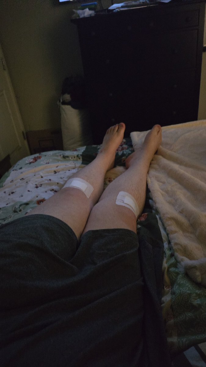 totallygray_'s tweet photo. More life updates, my tire blew while I was working, got my nose pierced and then I fell and cut up my knees while working today. Luck hasn't been on my side lol https://t.co/gP18cotMlt