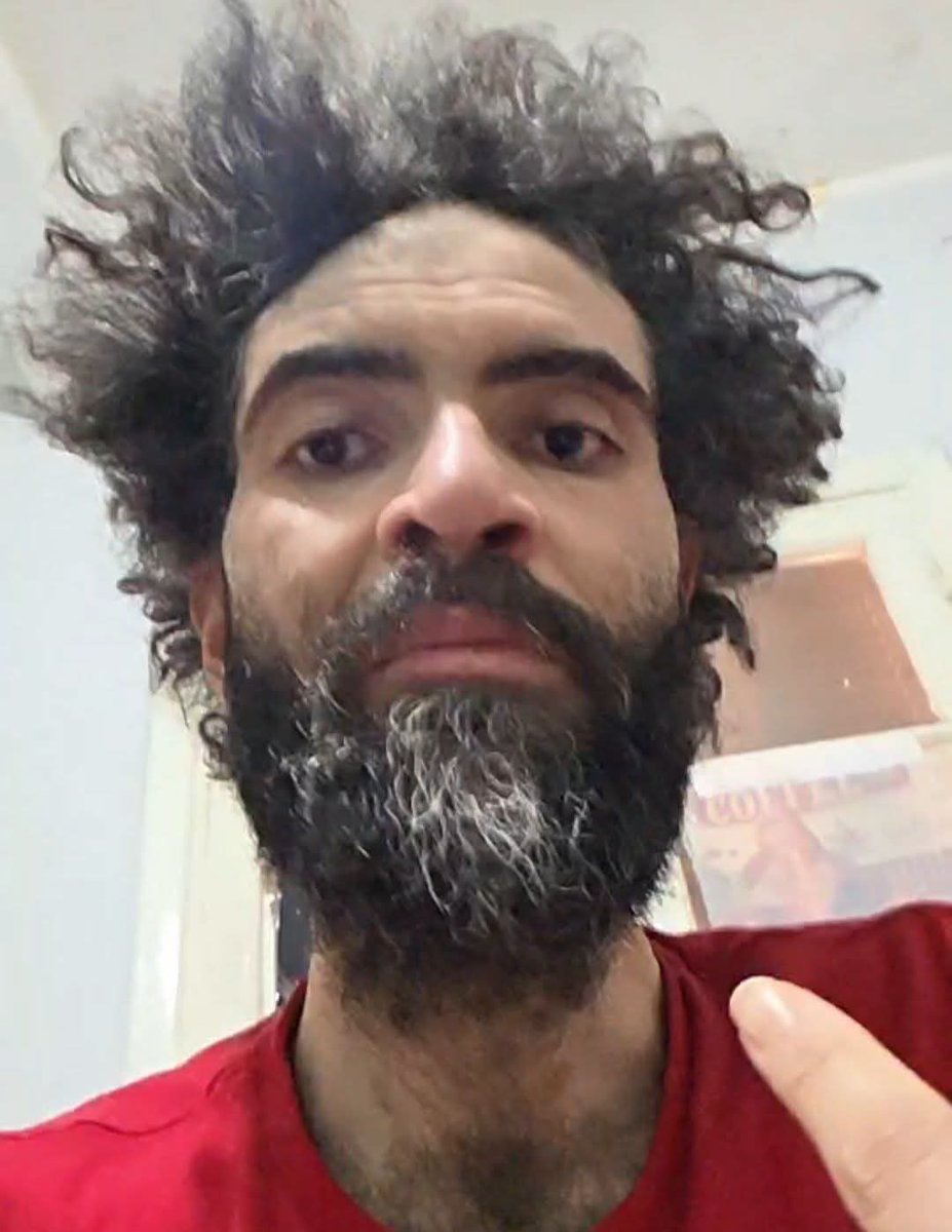CbnGhj90850's tweet photo. مهم لأحد المسؤولين 

اللي في الصورة ده اسمه محمد شوقي، طلع لايف النهاردة بيتكلم وهو بيعيط نتيجة مرضه.
هو مقالش في اللايف عنده ايه، لكن كل اللي طلبه انه يدخل مستشفى.

دورت شوية لقيت اخبار عنه بتقول إنه بيعاني من مرض مناعي نادر، بيخلي جسمه يفرز صديد وجلده ببتبهدل.

هو مش بيطلب فلوس، واعتقد ان الفلوس في حالته مش هتكون أكتر من شوية مسكنات، هو بيطلب حد يساعده يدخل مستشفى.

انا معرفوش ومعرفش أي تفاصيل عنه غير حسابه على الفيسبوك، بس أعتقد انه مش صعب إن جهة ما أو مؤسسة متخصصة تقدر تقيم الوضع وتشوف ايه اللي ممكن يتعمل لمحمد، لعل وعسى يكون فيه خير مكتوب له.

تاني هو بيقول إنه مش محتاج فلوس، هو محتاج مستشفى، وأكيد الجهات اللي تقدر تساعد هيبقى عندها طرقها.