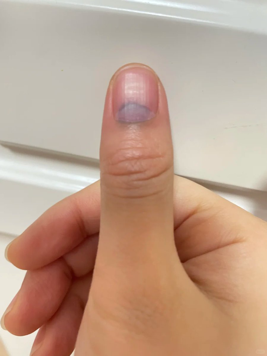 Ahud101's tweet photo. 今日水逆，做什么都不顺，需要找个阳人改改运！
有在线的吗？
#成都 个人
#女大 https://t.co/k05m15mlVa