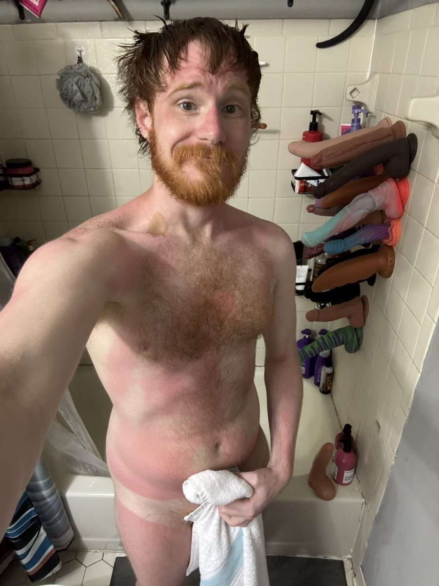 That1RedGuy's tweet photo. Ouch got a bit of a sunburn. Anyone want to help me apply some lotion? #gay #ginger #sunburn #shower https://t.co/ksnnxbozNI