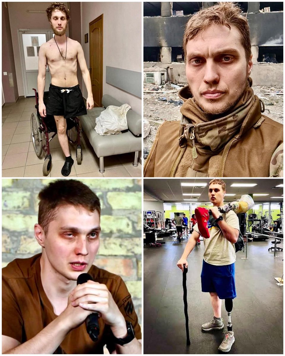 OlenaRohoza's tweet photo. No one believed he would survive. With injuries like his, the chances of living are almost nonexistent... But he endured.

Vladyslav Zhaivoronok, a fighter of the Azov Regiment, went through the hell of war, captivity, and unimaginable pain, yet never allowed the enemy to break him.

On the night of May 15–16, he suffered severe injuries. Despite his critical condition, Vladyslav remained in contact until the very last moment and managed to pass vital information to his command. What followed is a story that is difficult to believe even today.

His condition was so grave that the medics had almost lost hope. His pulse was barely detectable, and they were preparing to place him among the dead. But an anesthesiologist named Nina refused to let that happen. Beside her was a psychologist, Nastya, who immediately began searching for blood donors. Nearly unconscious, Vladyslav was asked about his blood type and Rh factor—and somehow, he was able to answer.

Several of his brothers-in-arms immediately volunteered to donate blood. Everything was done under conditions far removed from proper medicine: blood was mixed in a simple jar and transfused using a syringe. And it saved his life.

The operation was performed under constant shelling, surrounded by dust, debris, and complete unsanitary conditions. The damaged bone in his leg was amputated with an old rusty metal saw, and his wounds were stitched with ordinary fishing line. Yet even under such inhuman circumstances, the surgeons of Azovstal accomplished the impossible. Their work was a true act of heroism.

A few hours after the surgery, Vladyslav and other wounded soldiers were taken to Novoazovsk and later to Donetsk. There, he spent several months in captivity.

Doctors in occupied Donetsk did not believe he would survive. After Vladyslav regained consciousness, he received almost no medical care. Antibiotics were administered only several days later, dressings were changed infrequently, and his body temperature remained critically high. It seemed his body could not possibly endure.

But a miracle happened. Despite hunger, pain, infections, and the complete lack of proper treatment, his wounds began to heal. Even his damaged eye was saved, although it received very little medical attention.

In addition to physical suffering, the prisoners endured daily torture and relentless psychological pressure. They were told that Ukraine had forgotten them, that the war was lost, and that there was no hope. But Vladyslav refused to surrender. He endured.

On June 29, 2022, he was released during a prisoner exchange.

After treatment and rehabilitation, Vladyslav returned to life and today participates in campaigns supporting Ukrainian prisoners of war. He continues the fight—through different means, but with the same unbreakable faith.

“You must fight for your country at any cost,” says Vladyslav.

His story is not only about war. It is a story about the strength of the human spirit, about those who, even on the brink of death, do not lose their dignity, faith, or love for Ukraine. As long as people like him exist, our country cannot be defeated. Their courage will forever remind us of the immense price paid for freedom.

A deep bow of respect to you, Vladyslav. 🇺🇦