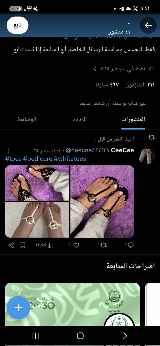 qq88012's tweet photo. @CuckkSluttt @Achrafyounes10 @medicine55_ @RealFlashRiver @RT_com مهنة رائعة حب الارجل استمر عليها لتنميها في المستقبل https://t.co/i38F9uPLaz