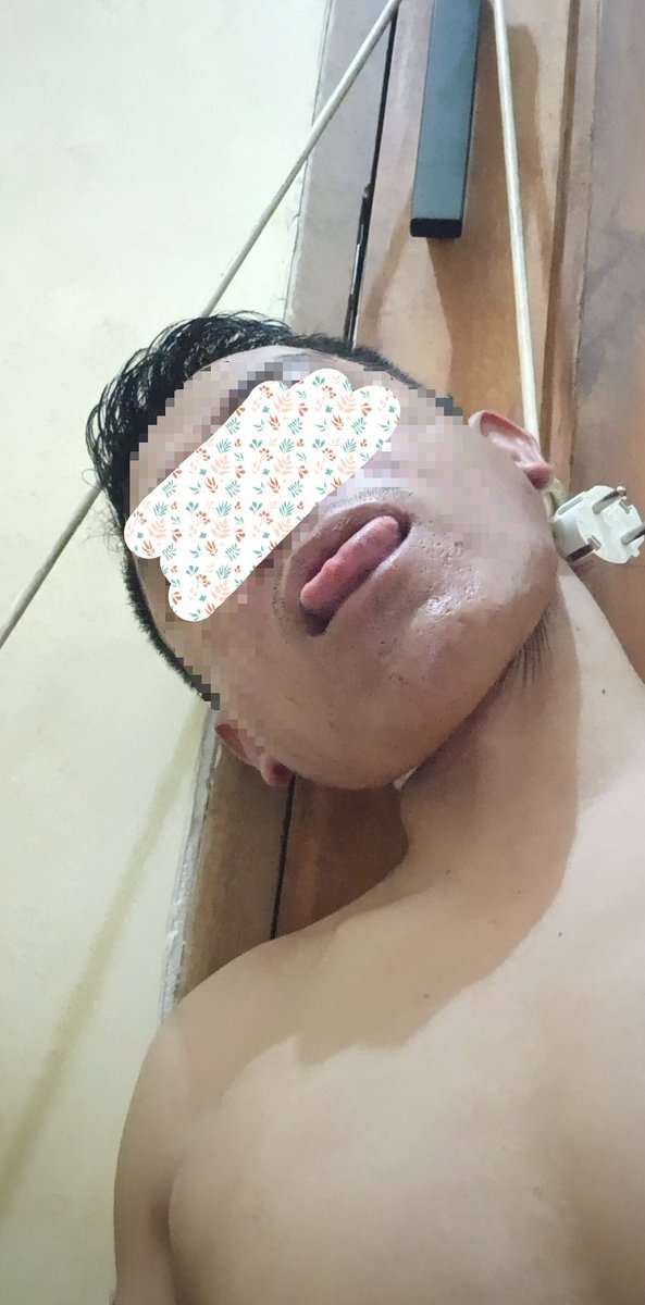 Ponakan002's tweet photo. Lets Play again
#strangled #hanging #selfhanged #breathplay https://t.co/6EgNhdZQls