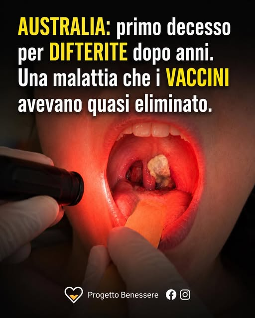 Nina6_15's tweet photo. Non sanno più dove sbattere la testa e tirano in balllo pure la difterite! PATETICI! https://t.co/q0Kyp3v3i4