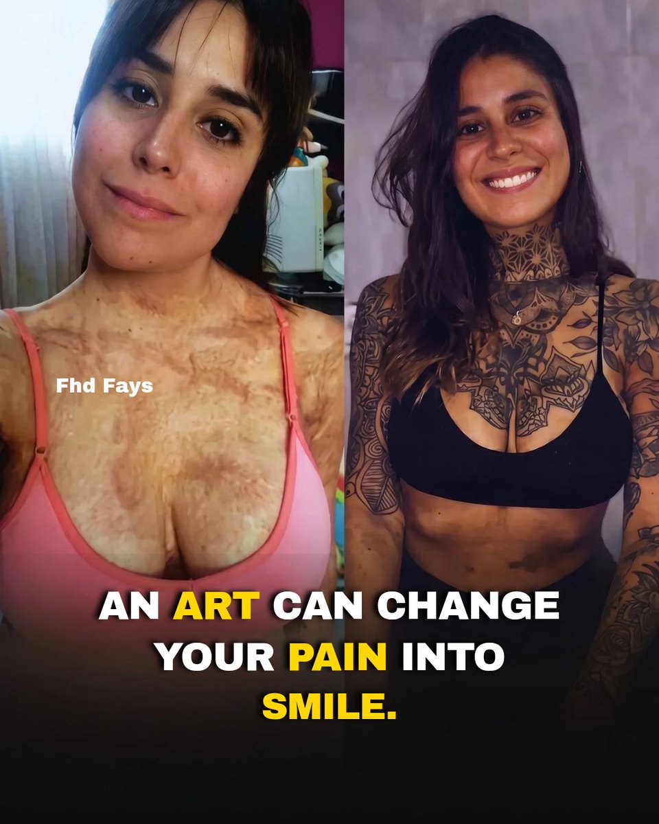 FhdFays's tweet photo. Art can turn pain into a smile.

Sometimes the scar remains—

but the way you see it changes. https://t.co/FuvkGF5IRt