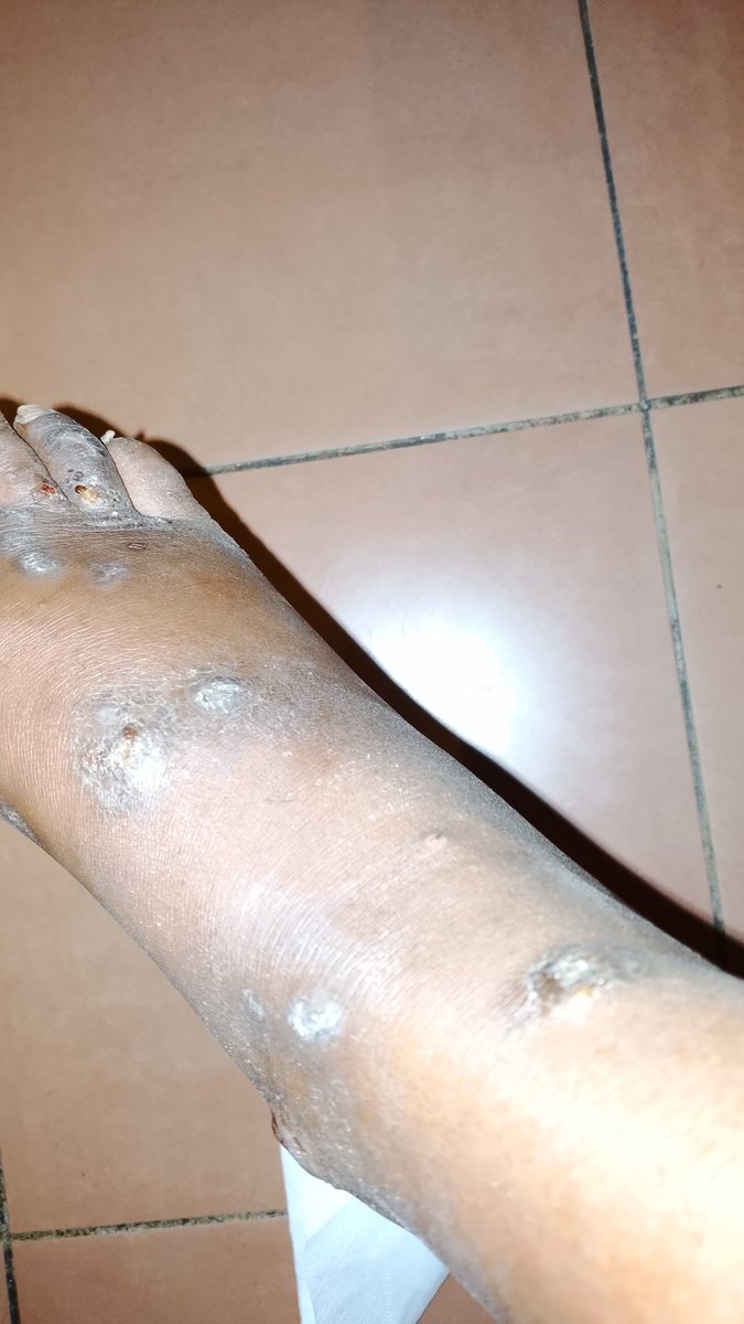 ___azmari___'s tweet photo. @TonyGachok15769 @KANUParty_ke @MoiGideon @ntv @EricLatiff @cbs_ke @NationAfrica Maybe answer your daughter's phone calls? Or care that she's homeless &amp; the target of a cult. I've been stranded &amp; victimized because of you &amp; nobody believes I'm your daughter https://t.co/Bq7KyHUpMe