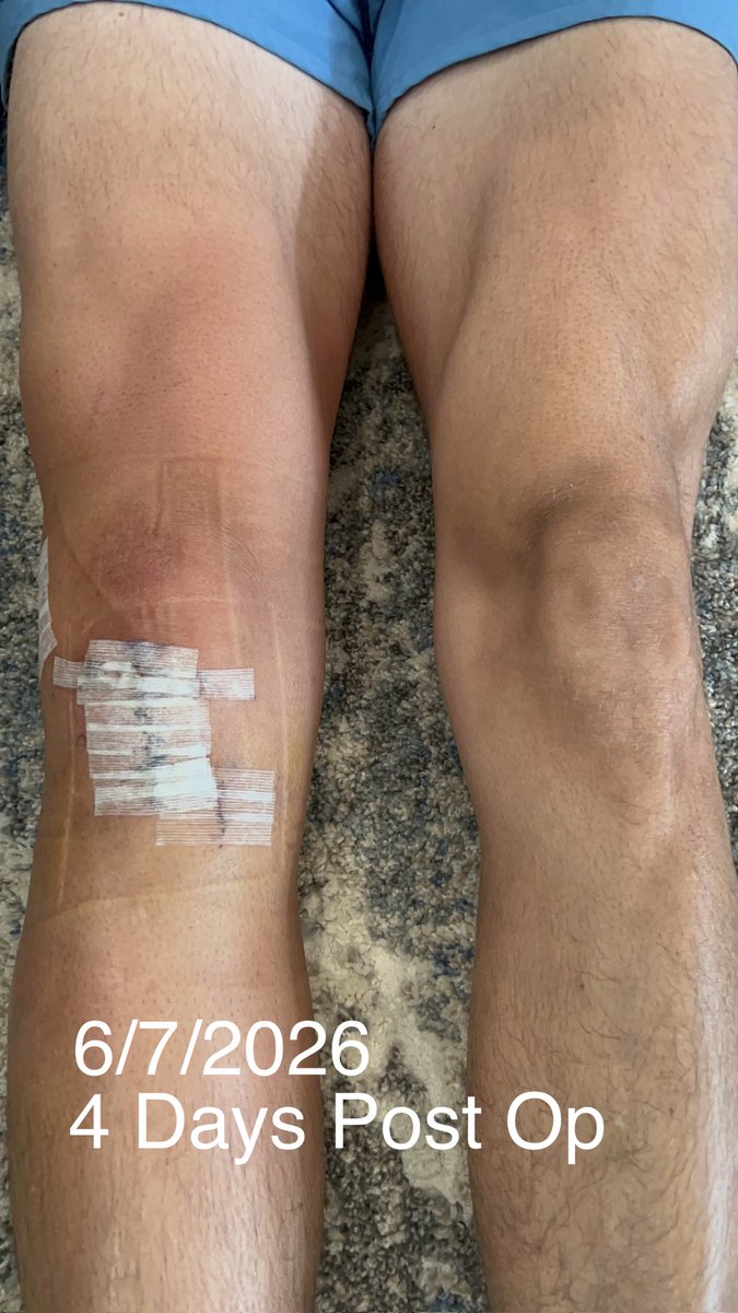 carterfrancis09's tweet photo. The spring and summer are not working out the way I had worked and planned. An ACL tear during spring football has me training in a very different way this year. My goal to return for a huge senior season and to find a university to play college football has not changed. This injury will drive me to work harder than ever before. I won't have game film to post this year but I will post updates on my progress towards being bigger, stronger, faster and better than before. If I was on your radar keep me there. You won't be disappointed. I will be back by March with measurables to prove it. I trust in God's plan for me to walk through this and I trust my work ethic and abilities to see me through. Stay tuned. #DelayedNotDenied 

@JHSWarriors_FB @JordanHSAthlet1 @pushthepocket @Coach_Sell_TX @CoachA_Moe