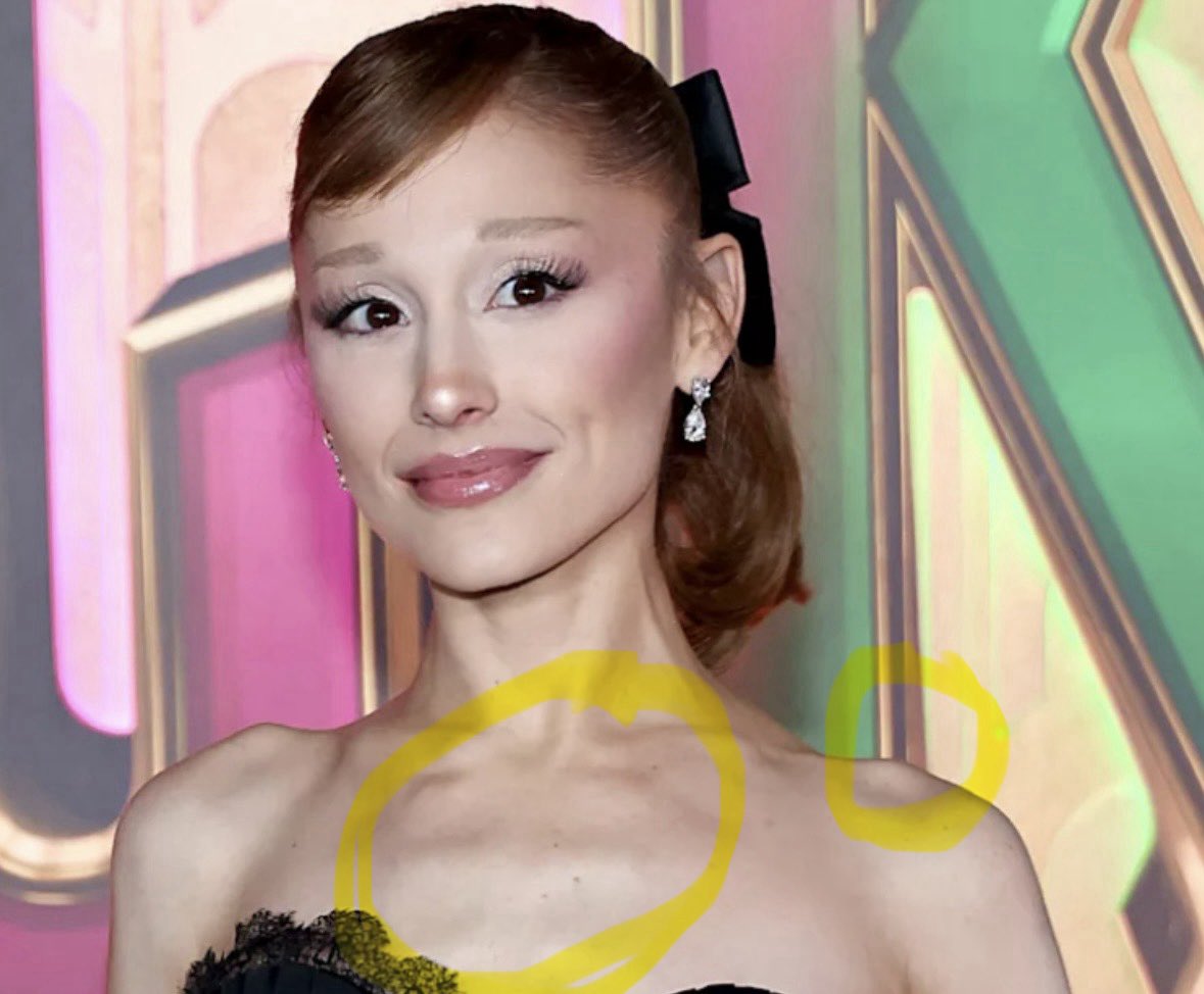 haleyk221's tweet photo. People always talk about Karen Carpenter but not enough people are talking about how Ariana Grande is literally skinner than she was… and she died from her anorexia. Rib cage visibility and the sharp piece of collarbone/shoulder bone — indisputable evidence of an ED. https://t.co/QG4bKJ3H0Y