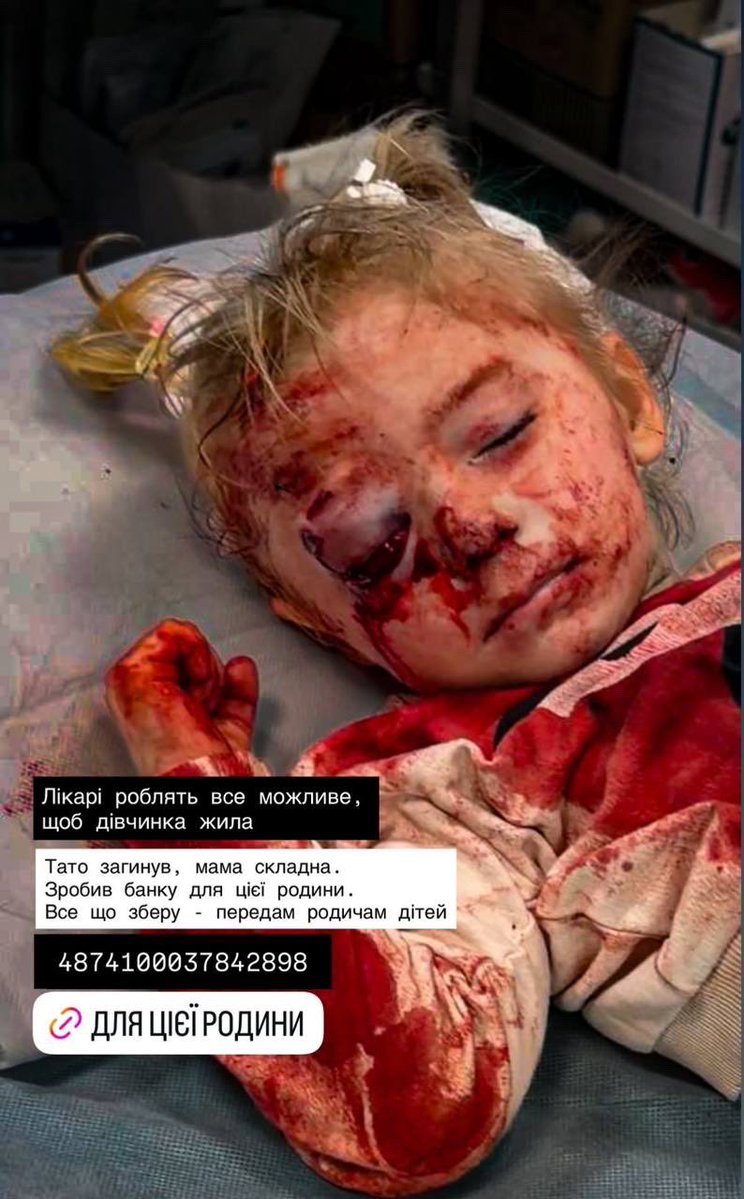 NafoFellas_Peru's tweet photo. Sé que es difícil, pero por favor, no aparten la mirada. 
Esto es lo que Rusia les hace a los civiles Ucranianos casi a diario. 
La gente necesita saberlo.
Esta en nosotros recordarle...

¿A QUIEN?
¡A TODOS! https://t.co/LaHcyyNwkx
