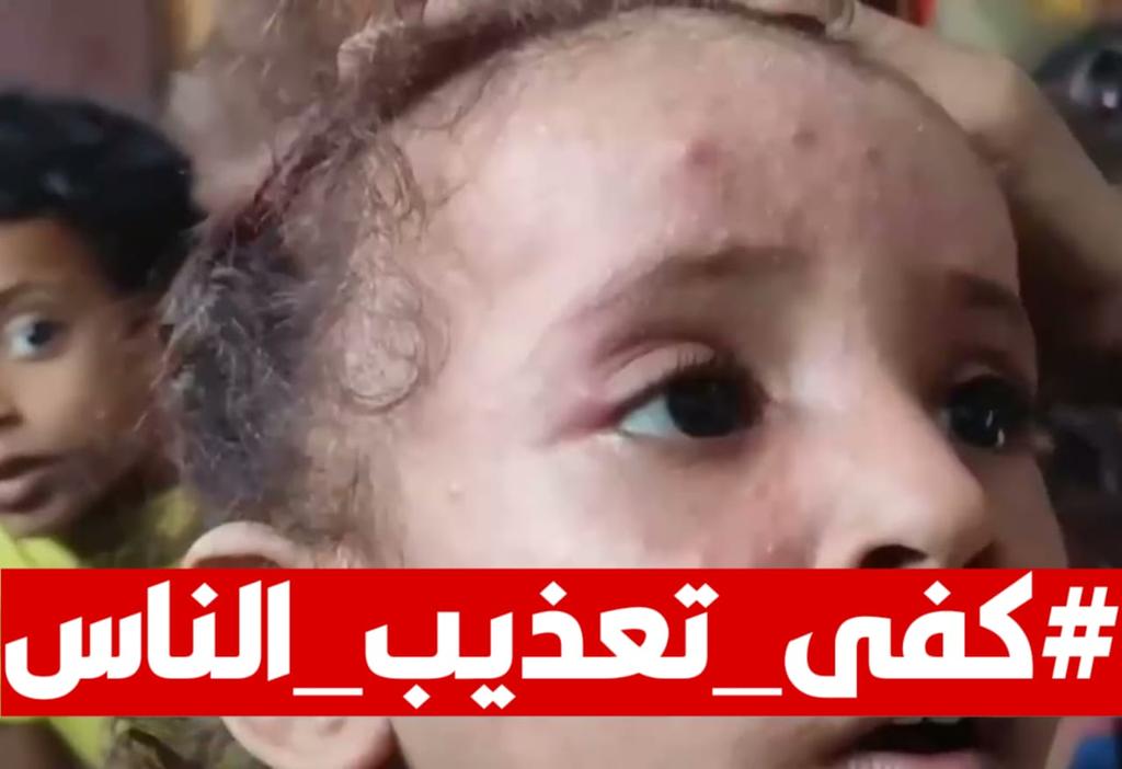 Rased_N's tweet photo. نداء عاجل ومسؤول من أبناء عدن والمحافظات الساحلية إلى السعودية والسلطات العليا: الوضع الخدمي والصحي ينهار تماماً. #كفى_تعذيب_الناس https://t.co/LCdJFumyk8