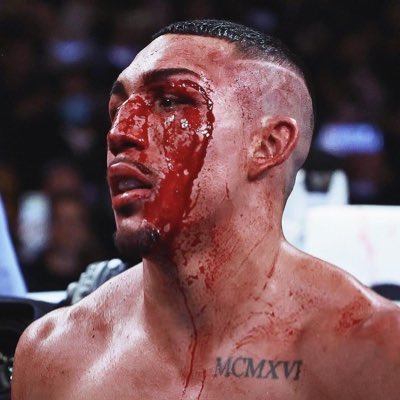 RayJack97010720's tweet photo. Shakur doesn't need KO power, I'll take sharp and accurate punches...had that boy Teo leaking 😬 https://t.co/f24HIsgS8L