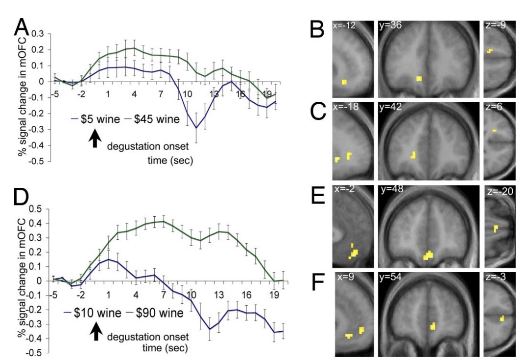 BrandonLuuMD's tweet photo. I’m convinced most of the wine industry is placebo.

People rate the same wine as more pleasant when they think it is more expensive.

The higher the perceived price, the more activity increased in a brain region linked to experienced pleasure. https://t.co/xwpTbreLwj