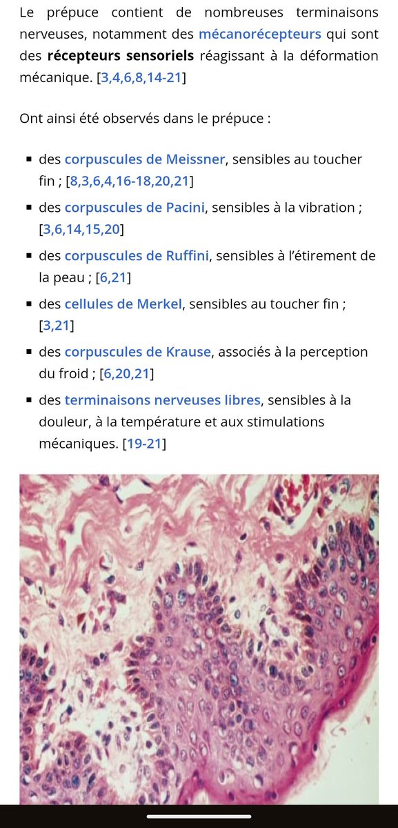 moricryopsld's tweet photo. @ControloTe45315 @PurpleAndrw @utd270 @fruitblanco Regarde tout les trucs qu'il y a dans le prépuce https://t.co/Pmjivon7f3