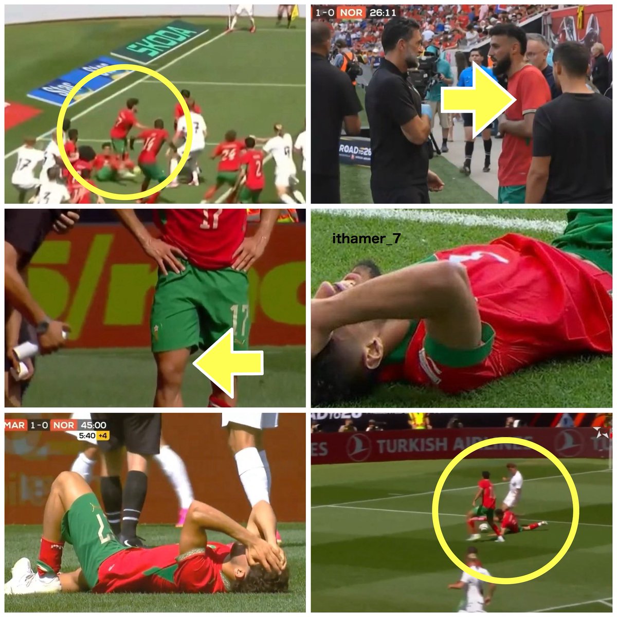 ithamer_7's tweet photo. 🚨🚨🚨🚨🚨 عااااااجل .. إصابات المغرب 🇲🇦 

- إصابة مزراوي بإصابة على مستوى الكتف بعد السقوط عليه وهذي الطريقة ممكن تسبب ( كدمة / خلع جزئي في المفصل ) أكمل جزء من المباراة وبعدها تم استبداله.

( المتوقع إصابة بسيطة ويقدر يشارك ولو بتثبيت المفصل )

- إصابة الزلزولي ( سيء الحظ )! بعد سقوط زميله شادي رياض على ركبته ودخولها للداخل وهذا قد يسبب:

▪️أفضل الأحوال: ( كدمة / التواء بسيط ) ✅
▪️الاسوأ: ( إصابة في غضروف أو رباط الركبة الداخلي ) ❌

#إصابة_ملاعب #Worldcup
