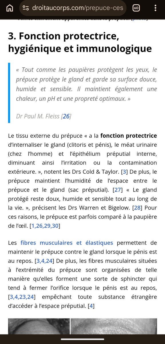 moricryopsld's tweet photo. @ControloTe45315 @PurpleAndrw @utd270 @fruitblanco Même pour l'hygiène ça aide https://t.co/Uzk8CW9Wfs