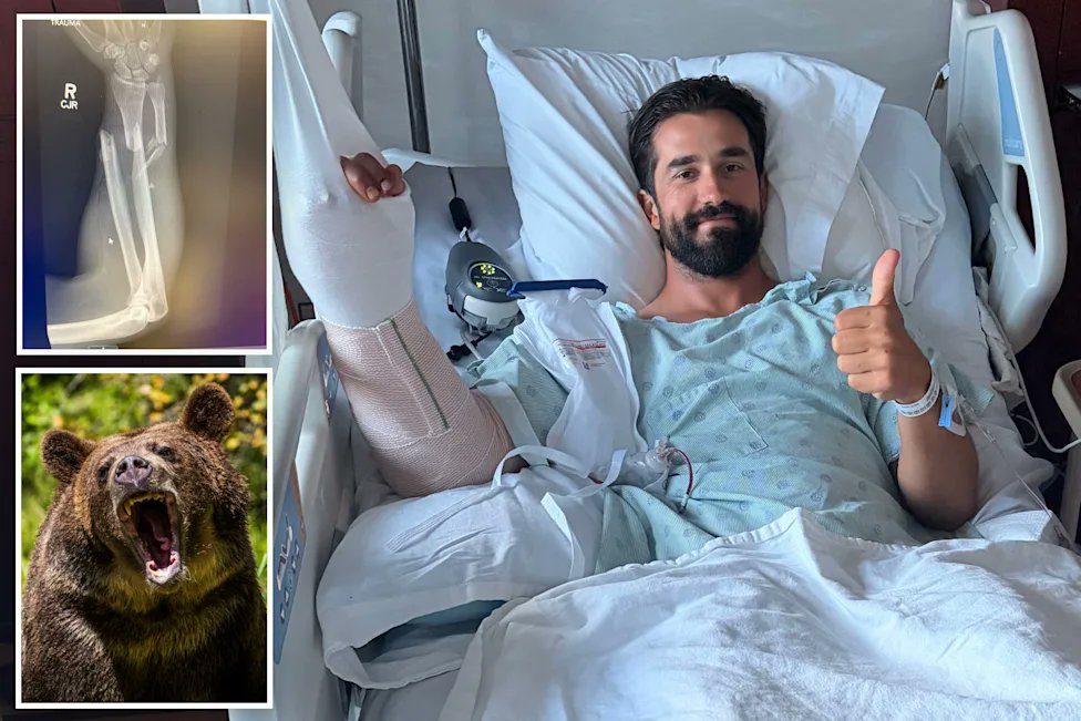 maxxhazard's tweet photo. Wow, look at the damage from one bite of a bear.
A Montana hiker surprised a grizzly bear that charged as soon as it saw him. 
The 32yo threw up his arms and the bear bit, dragged him about 20ft, then ran off. https://t.co/qjkbe0R1vA