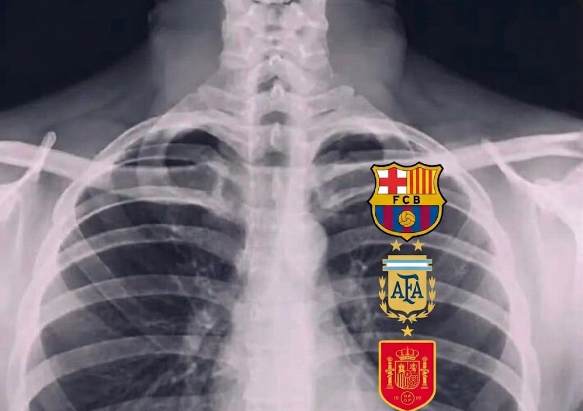 _benopaonyx1's tweet photo. The heart of every Barca fan ❤️ https://t.co/x5Ct1vhOqP
