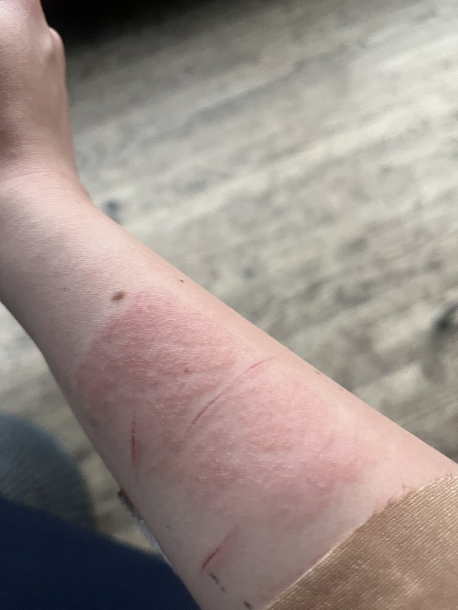 lorem3sum's tweet photo. this rash is so fucked and evil wtf https://t.co/jpCTYBCEho