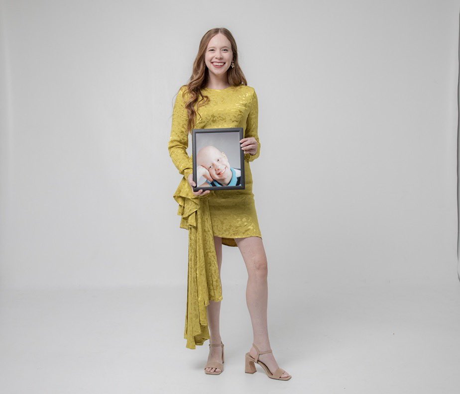 ArceneauxHayley's tweet photo. Today is National Cancer Survivors Day 🎗️

Being a childhood cancer survivor has taught me resilience, gratitude, and finding joy in ordinary moments. I’ve learned that survivorship isn’t just about what you overcome, it’s also about how you live life after. I’m incredibly grateful for my team who cared for me, believed in me, and gave me hope.
Sending love to fellow survivors and to everyone who has been touched by cancer 💛