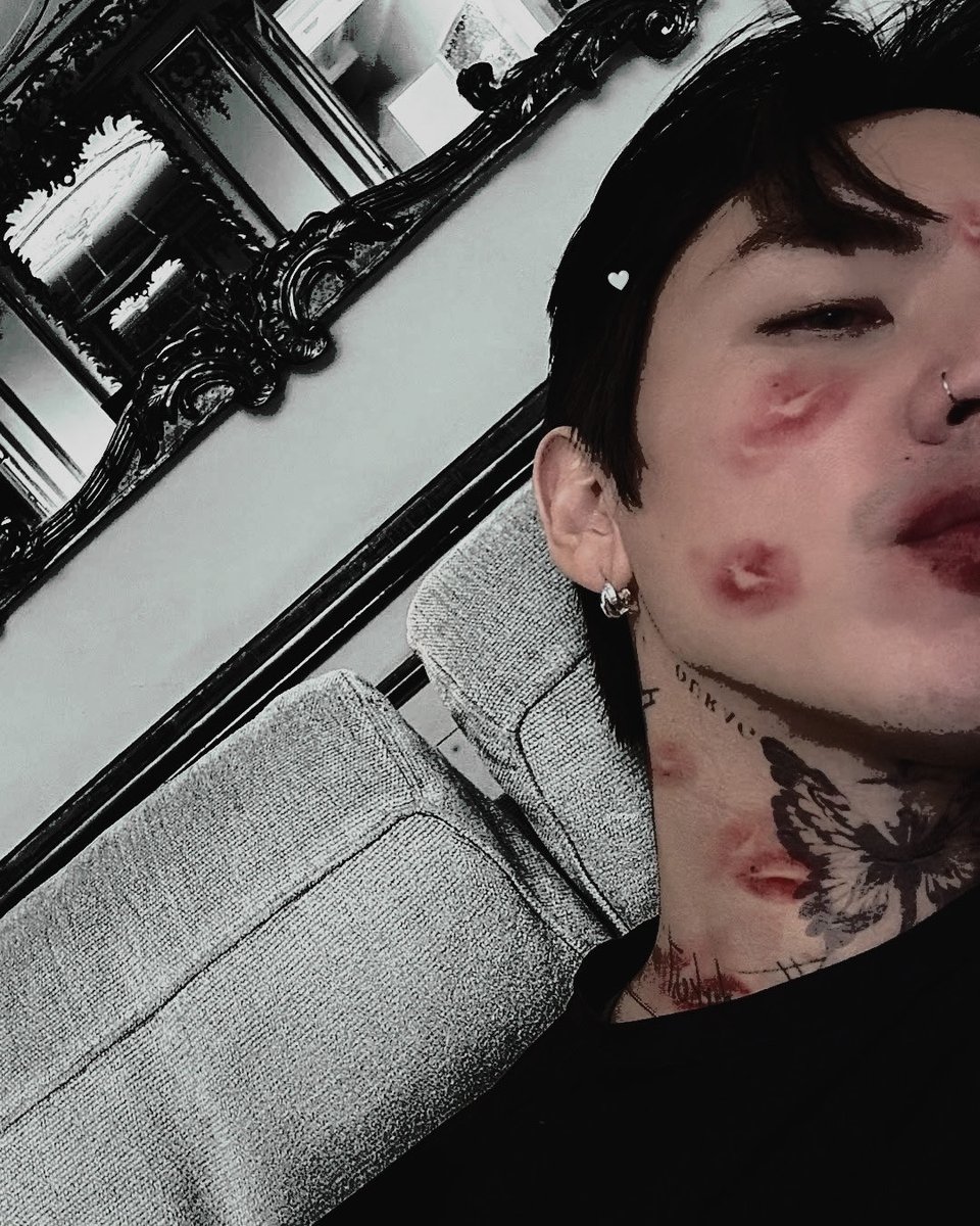 ✪ 𝒋𝒂𝒄︭𝒆︭ tweet media