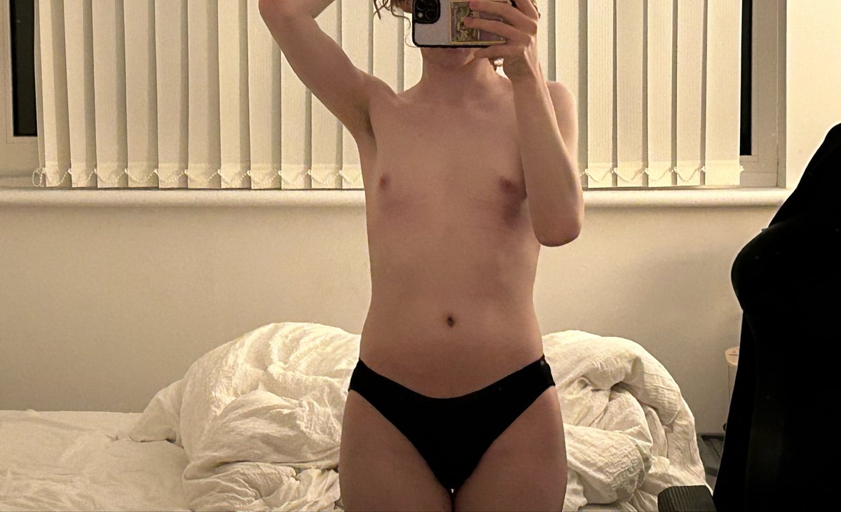 subbyskunk's tweet photo. lazy post but I love what hormones have done for me https://t.co/P3M2rmEovv