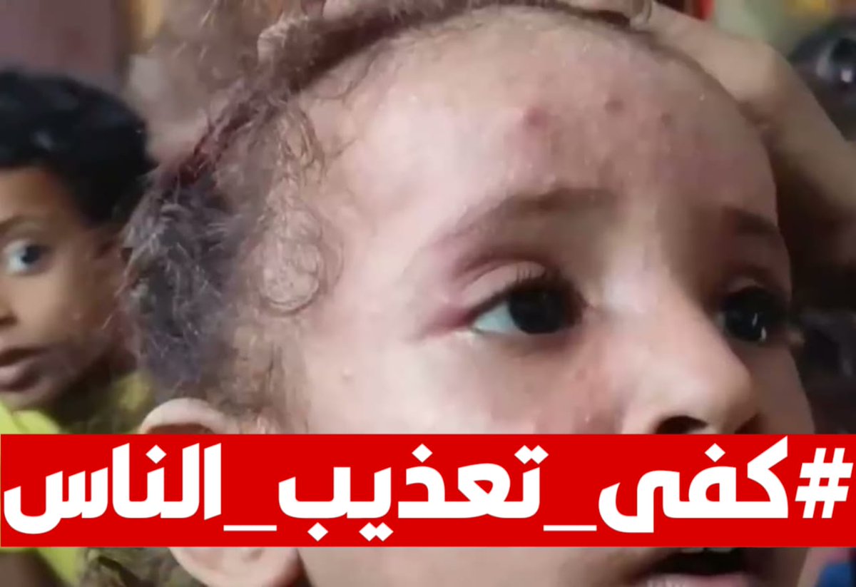 Swalef200's tweet photo. ندعو كافة الأقلام الحرة والناشطين في عدن والمحافظات الجنوبية لتوحيد الصوت والضغط المستمر حتى انتزاع الحقوق الخدمية المشروعة لأهلنا. #كفى_تعذيب_الناس https://t.co/EcqUaTvW5g