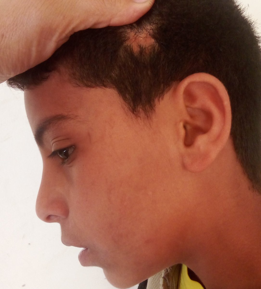 RozeatG's tweet photo. Don't ignore me, please 😭😭🙏
My son's hair is falling out profusely. A bacterial infection has spread due to contaminated water and a lack of cleaning supplies. Please help us. Donate so we can buy the necessary treatment and cleaning supplies. Please

https://t.co/PoTNVpFiJv https://t.co/WO8jYj42lU