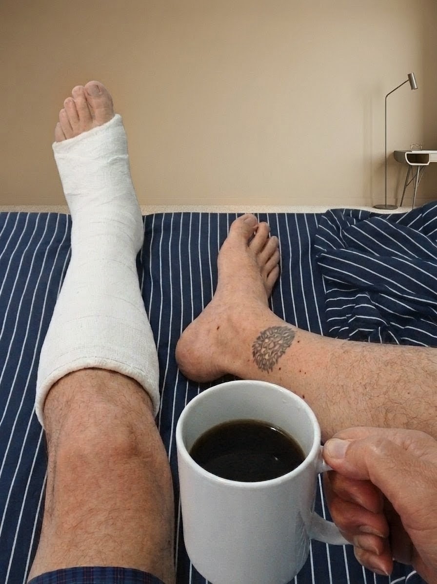 CADGregorio's tweet photo. Una taza de café, oyendo la lluvia caer y descansando el pie, está culminando está tarde 🩼☕👣🌧️ https://t.co/Oz5lRts1Ee