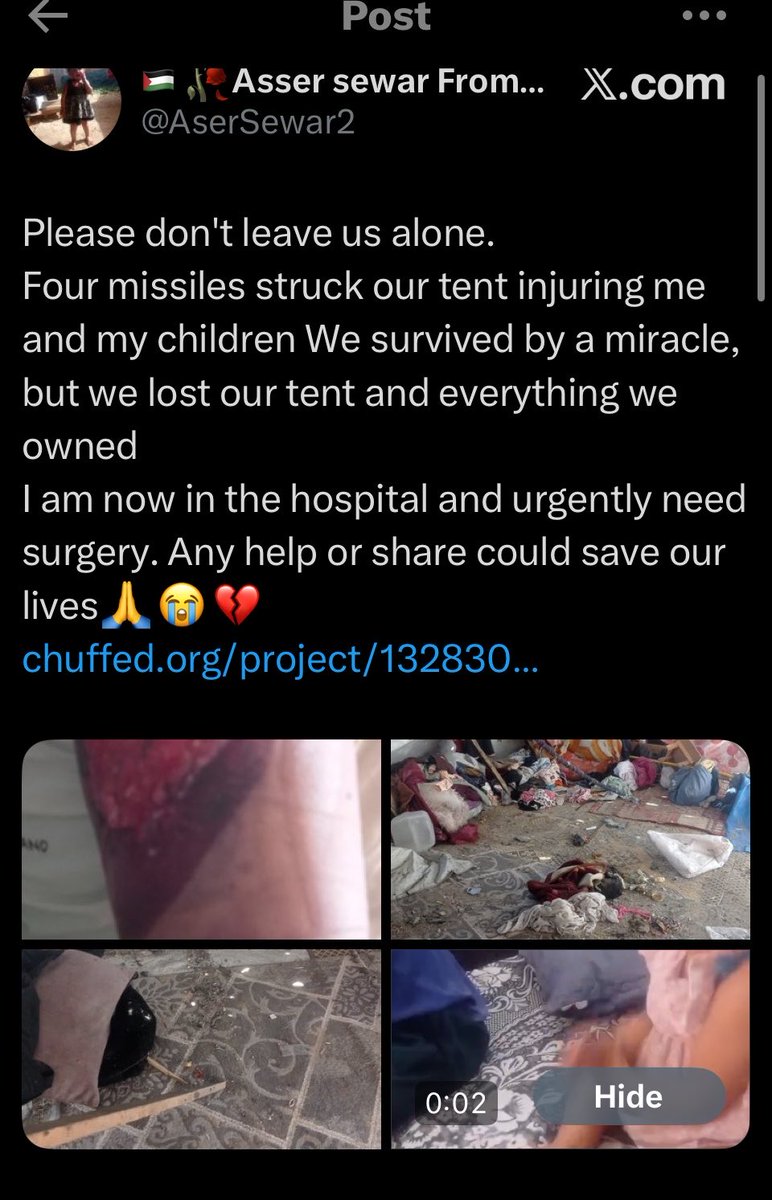 FIRELacieNOW's tweet photo. This woman is a @RadioWatermelon “verified” person. Last night her tent was demolished and rocket shrapnel tore thru her arm and injured her kids she’s been pleading day n night to @LeftieLeo @MissRinaIdrus for donations and support instead they stay Twitter beefing ignoring her https://t.co/bKbolPcAm7