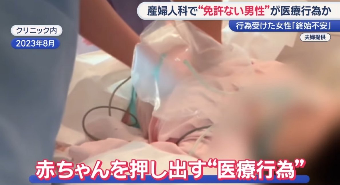 ejyou_bot's tweet photo. 【戦慄】
福岡の人気産婦人科で起きた「地獄」
医師免許のない職員が医療行為を強行。

■ 事件の全貌
福岡市内のクリニック。
手術着を着たペルー人男性が登場。
分娩室で妊婦の腹部を全力で圧迫。
赤ちゃんを無理やり押し出しました。

■ 生ﾀﾋの境
女性は「4リットル」の大量出血。
通常分娩の8倍以上に及ぶ、凄まじい量。
一時は意識不明となり、ICUへ。
3日間にわたりﾀﾋ線を彷徨いました。

■ 信じがたい「釈明」
院長は「彼は技術を持っている」と主張。
「日本語が書けないから試験に受からないだけ」
「感謝されない理由がわからない」
あろうことか、被害者を逆なでする言葉。

■ 数字で見る衝撃
・出血量：4リットル（致ﾀﾋレベル）
・ICU入院：3日間
・容疑：医師法違反（書類送検）

命を預かる現場での、あまりに身勝手な論理。
「確かな技術」の前に「法」と「命」がある。

この無責任な対応に、憤りを感じたらRT。

自分や家族の身を守るために、保存。