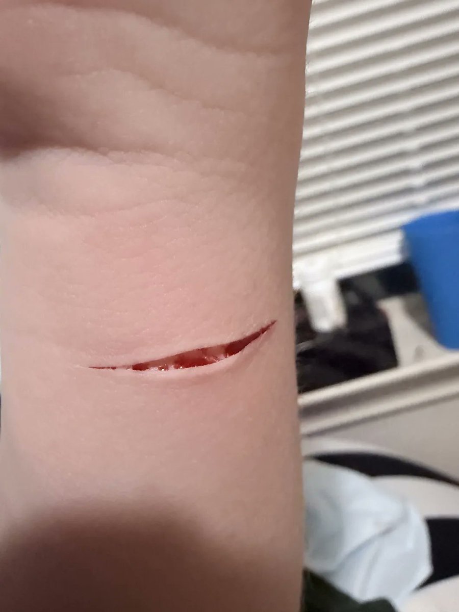 PixelatedRotxx's tweet photo. See more SHEDTWT content in our discord!!! 
https://t.co/fAPToip2mB
#shedtwt #shtwt #edtwt #drugtwt #shtなりきりさんがrtしてくれてそれを見たshtなりきりさんがきっとフォローしてくれる https://t.co/7DfQKEgFHg