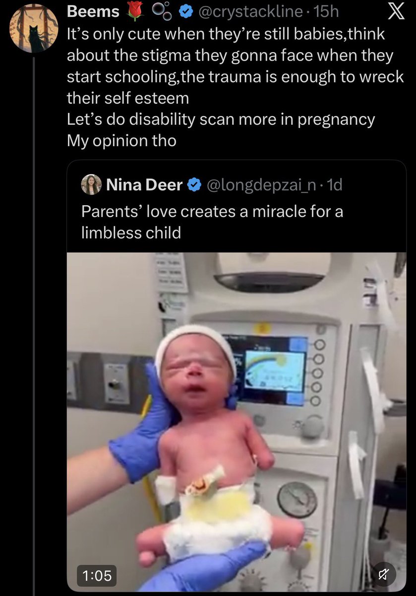 HazelAppleyard's tweet photo. People really just be calling for prenatal genocide of disabled babies nowadays. 

Would you tell a grown man with no limbs that his life wasn’t worth living? That he would be better off dead? https://t.co/pWcRedrVZN