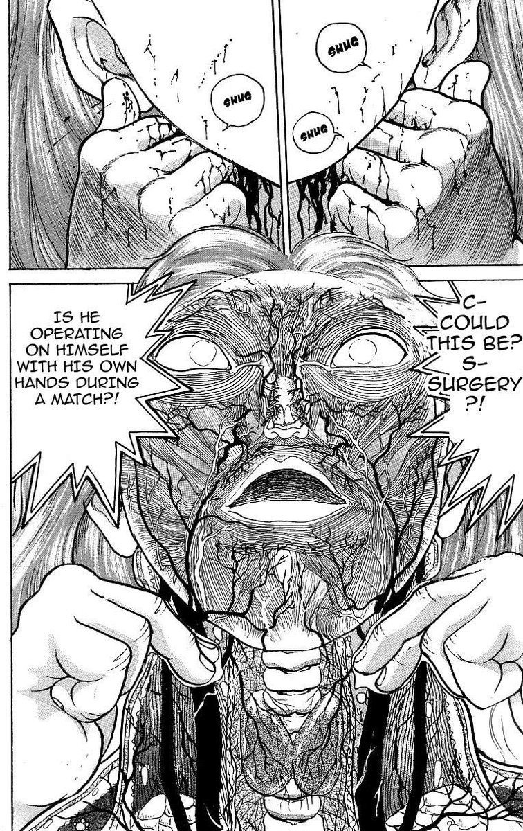 DogSavior_'s tweet photo. @Deizu0 @SulemioGayPorn How about when he did it on his surgeon brother who proceeded to reattach them himself https://t.co/BStpk6Mh2e
