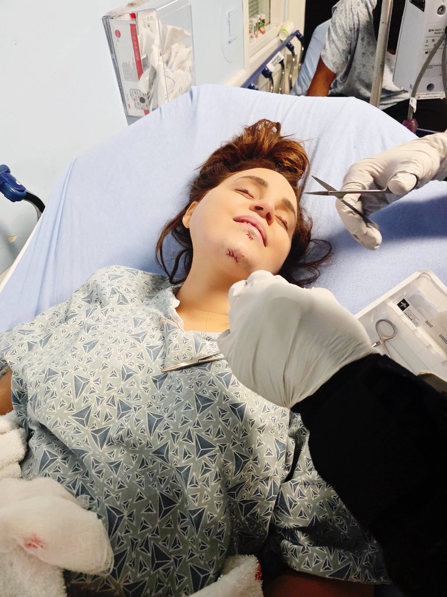 RosannaPansino's tweet photo. OMG! I faceplanted hard while on a yacht celebrating my birthday and broke my jaw in 3 places, had to get 6 stitches, and knocked out multiple teeth! 💀

Was told I need to talk to a jaw surgeon immeditely… and I didn’t even get Netflix boxing money!

Will update you all as soon as I can. I cant talk and can only eat protein through straw. My entire face is swelling up like a balloon.

Here’s to 41! ❤️‍🩹😭
