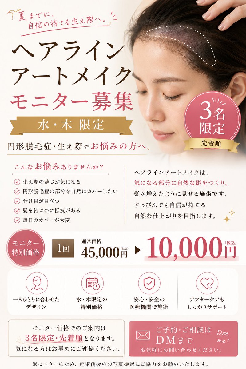 a_chan__'s tweet photo. #ヘアラインアートメイク　#アートメイク東京　#生え際　#円形脱毛症 https://t.co/I2dUUee7fU