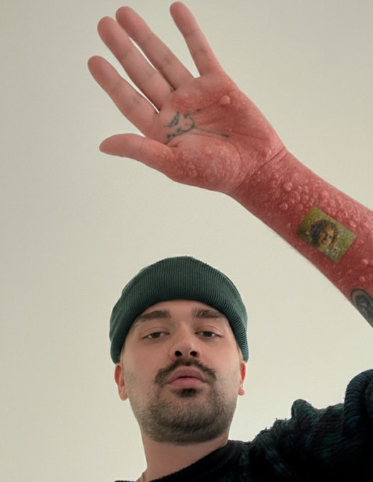 OnGodNews_'s tweet photo. Random shoegaze fag is going to die from getting "KANE PARSONS" tatted on his forearm using a poopoo needle! https://t.co/GDQ7n0GlQc
