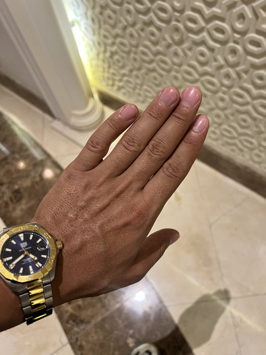 sahipvolkanx's tweet photo. Fresh hands! Pedicure and manicure done for today! You keep working and sending me my money!  😎🏧

https://t.co/53BeBIV9Lr https://t.co/hlD4vJNnxt