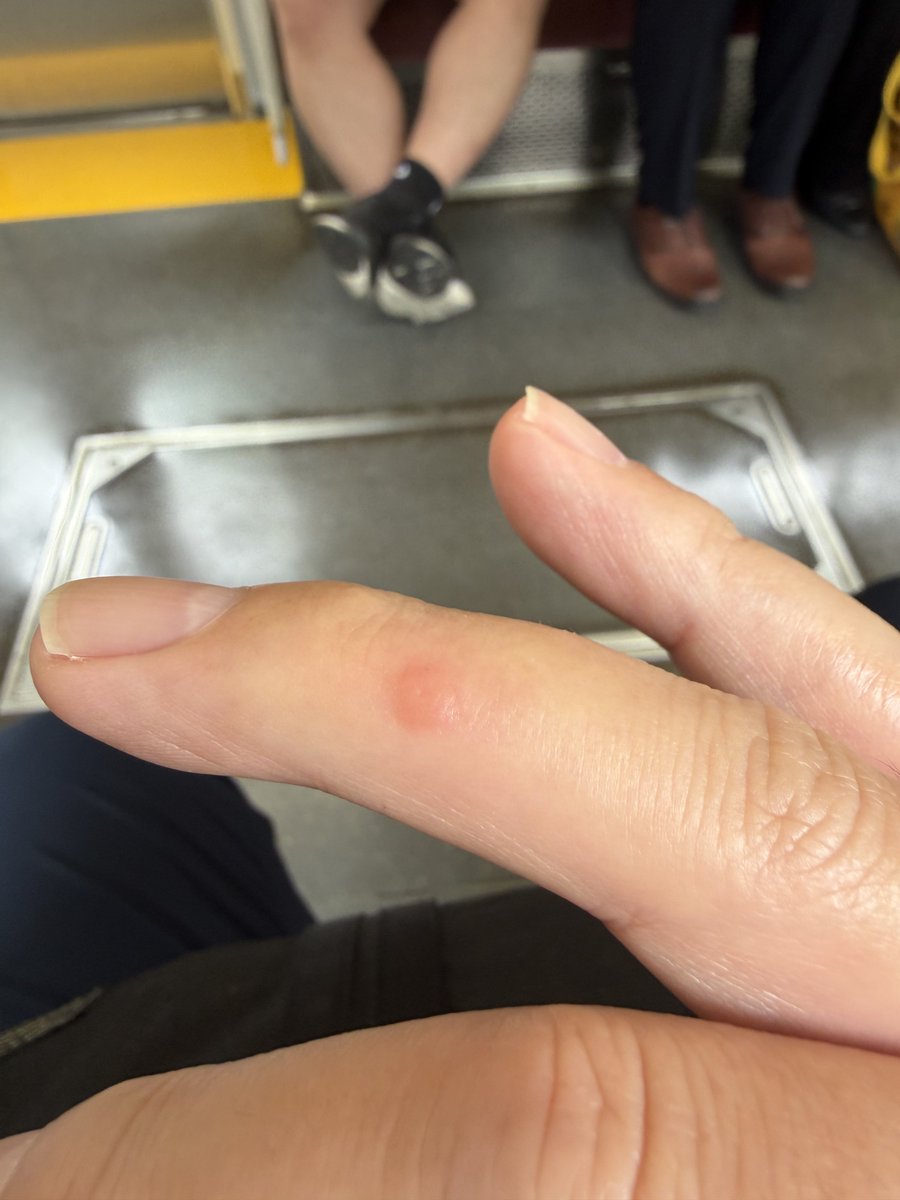 graphicas's tweet photo. ヌカカぶっ殺す🤬 https://t.co/f8XyYRIGzs